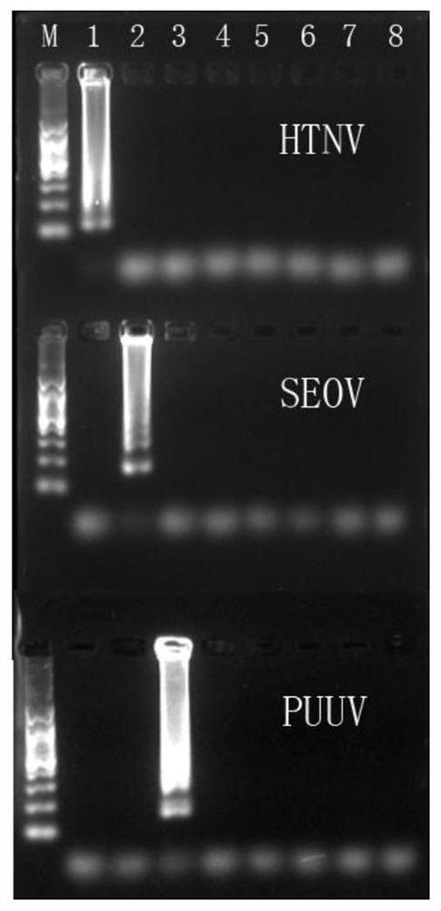 用于檢測(cè)漢坦病毒的檢測(cè)引物、檢測(cè)試劑盒及檢測(cè)方法