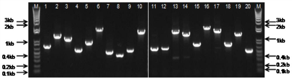 一種棘阿米巴特異性抗原肽、多克隆抗體及其用途